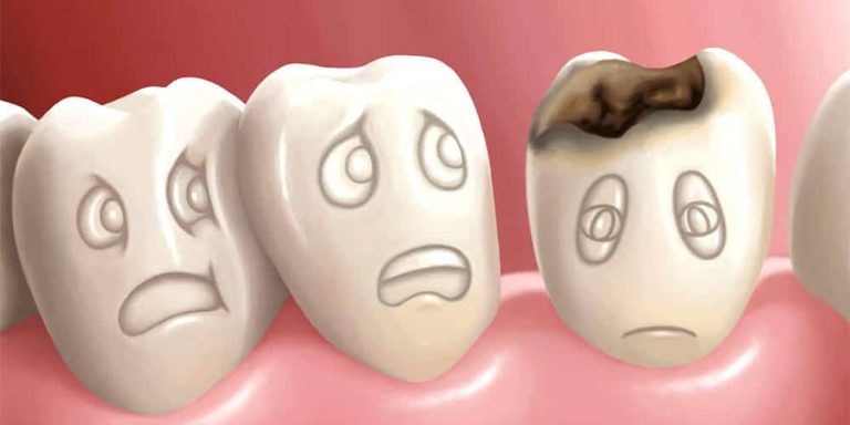 رنجِ نان و  غم دندان!/ معاون وزیر بهداشت: 50 درصد هموطنان گرفتار بیماری های دهان و دندان هستند